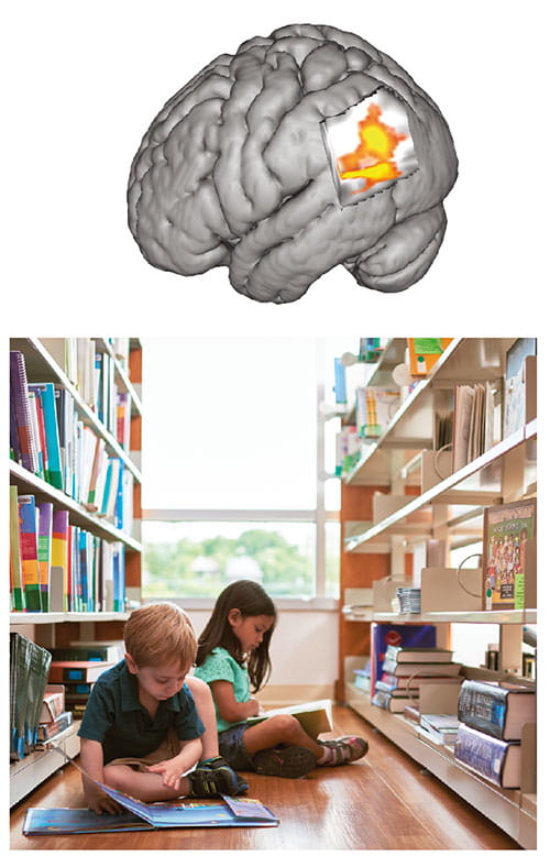 Fig A:  This 3-D image of the posterior left hemisphere—the side typically dominant for language—features a bright area of increased brain activation when children listen to stories read to them. The activated area is the parietal-temporaloccipital multi-modal association cortex, a hub for integrating multi-sensory inputs. This study indicates that children with greater exposure to books and shared reading at home tend to be better at self-generating the visual images associated with imagination and narrative comprehension.  